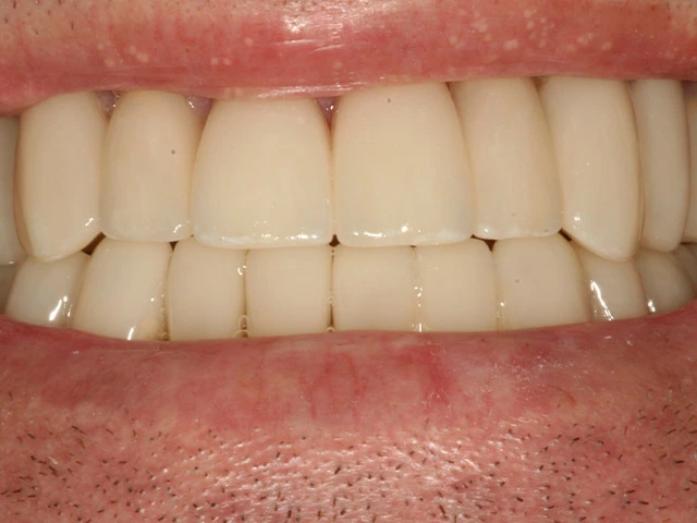 After image