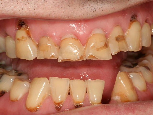 Before image