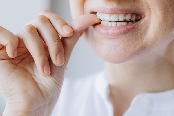 What Happens If You Never Clean Your Teeth When Using Clear Aligners?