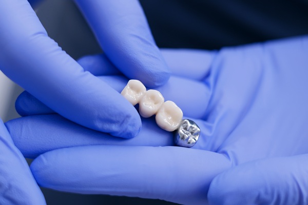 Ways Dental Bridges Can Restore Your Smile